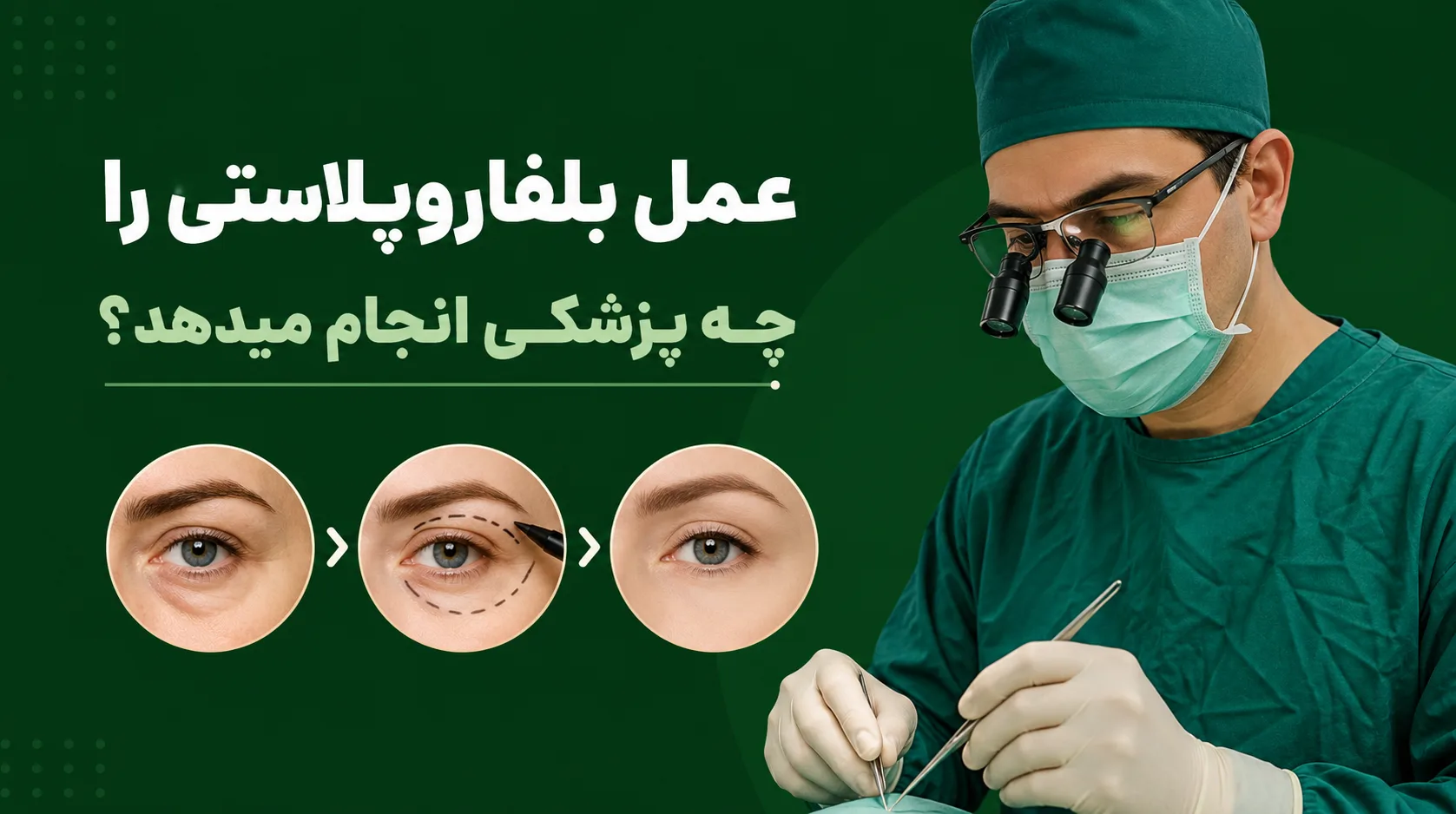 عمل بلفاروپلاستی را چه پزشکی انجام میدهد؟